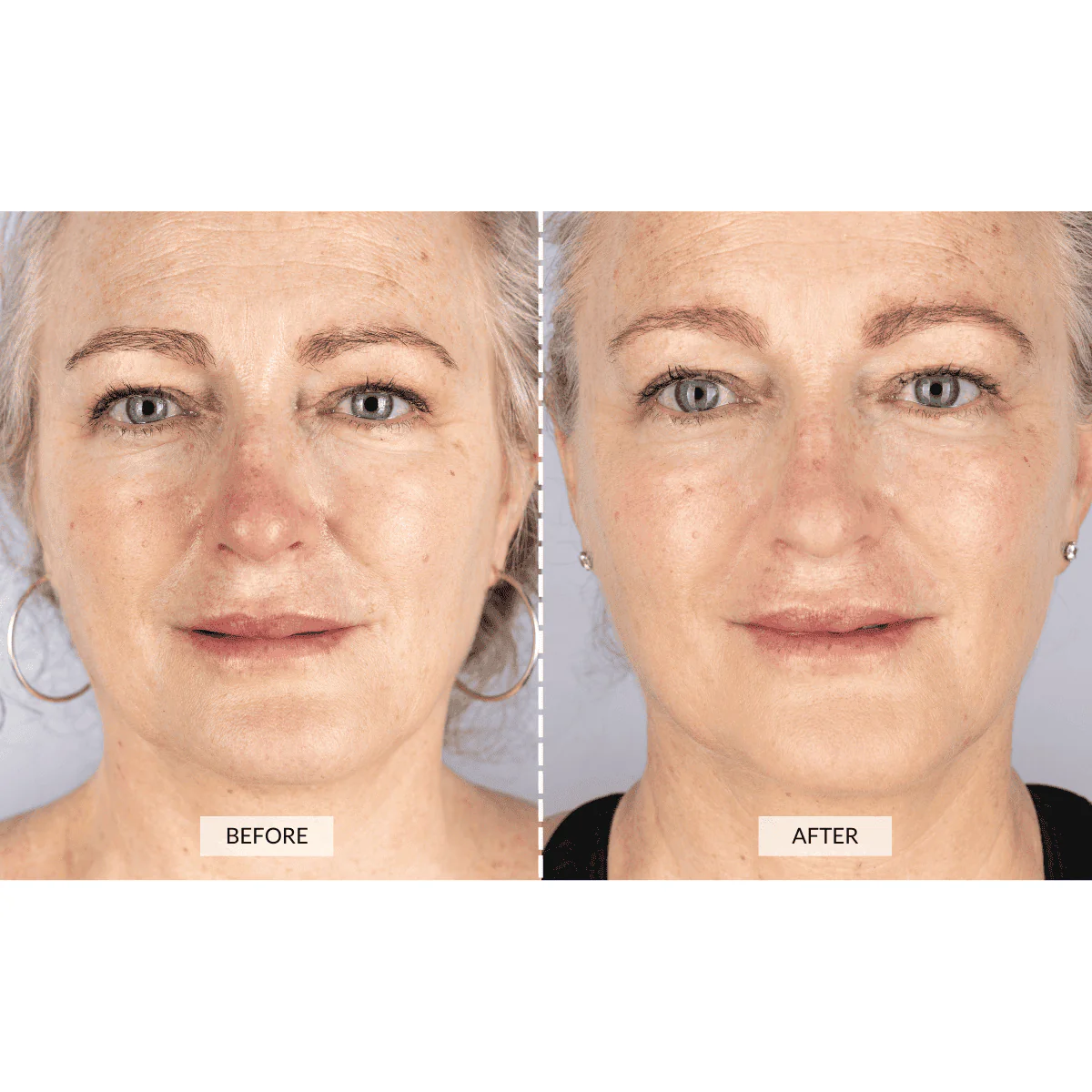 Currentbody - Silver Series 1 LED Mask Gift Set - Image 4
