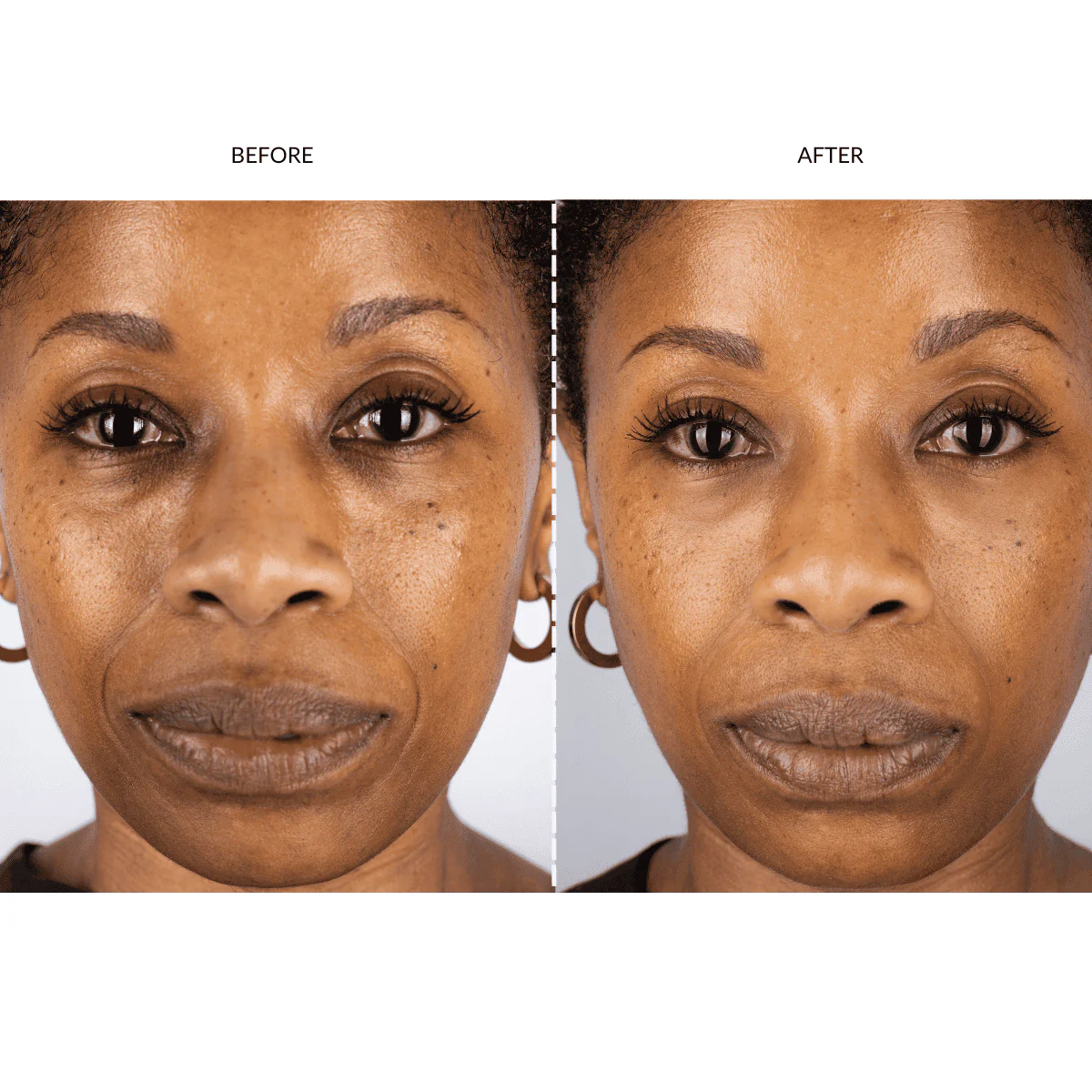 Currentbody - Silver Series 1 LED Mask Gift Set - Image 5