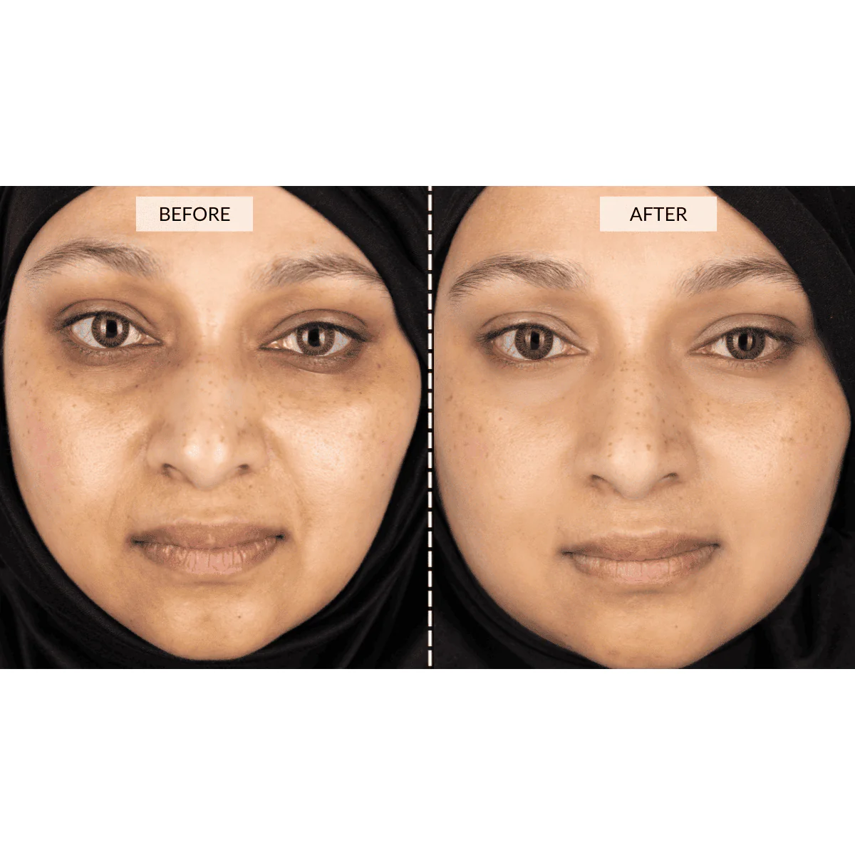 Currentbody - Silver Series 1 LED Mask Gift Set - Image 6