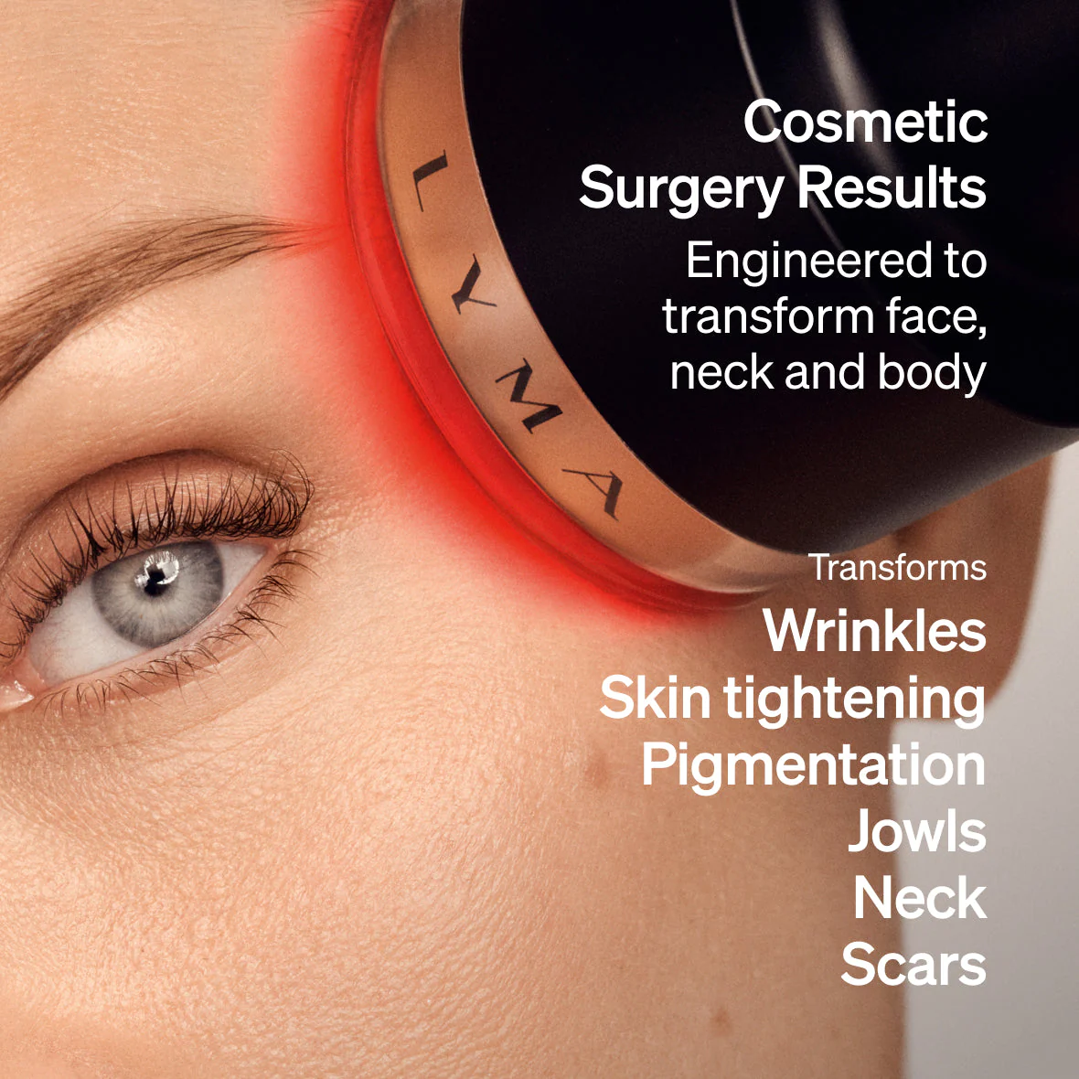 Lyma - LYMA Laser PRO - Image 13