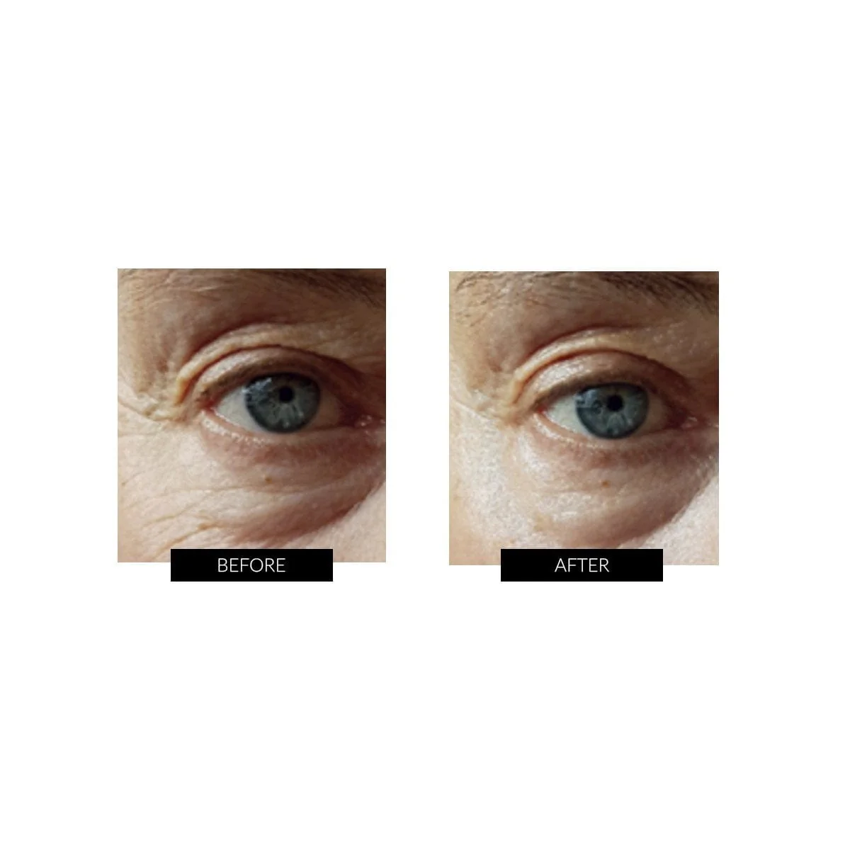Currentbody - OXYjet GO Oxygen Facial System - Image 7