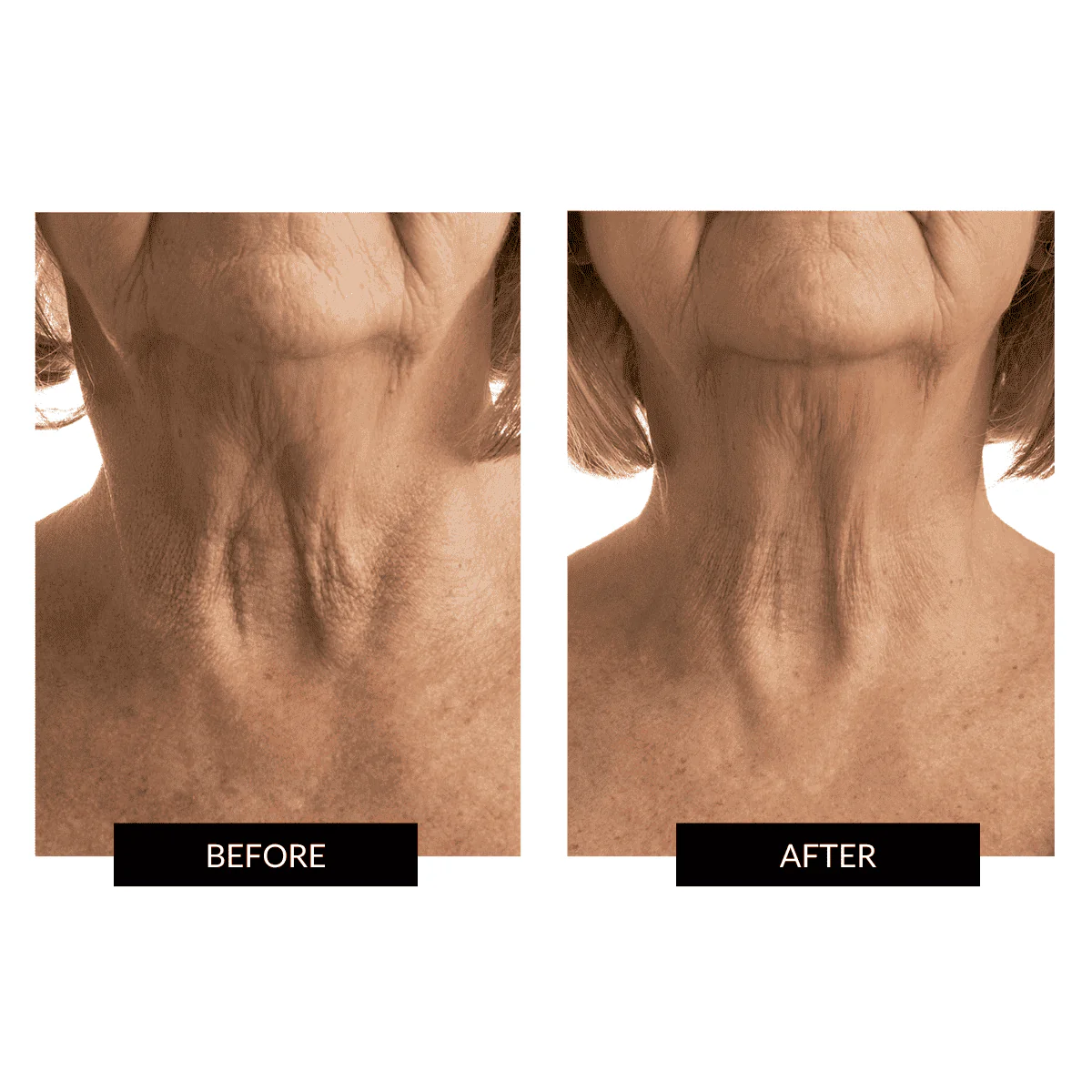 Currentbody - RETURNS - CurrentBody Skin Face & Neck Kit - Image 10